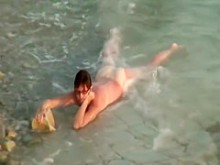 Mujer quemada por el sol está desnuda en una playa